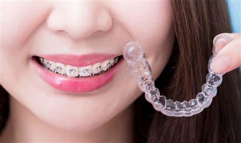 Are Witching Smile Teeth Braces Right for You?